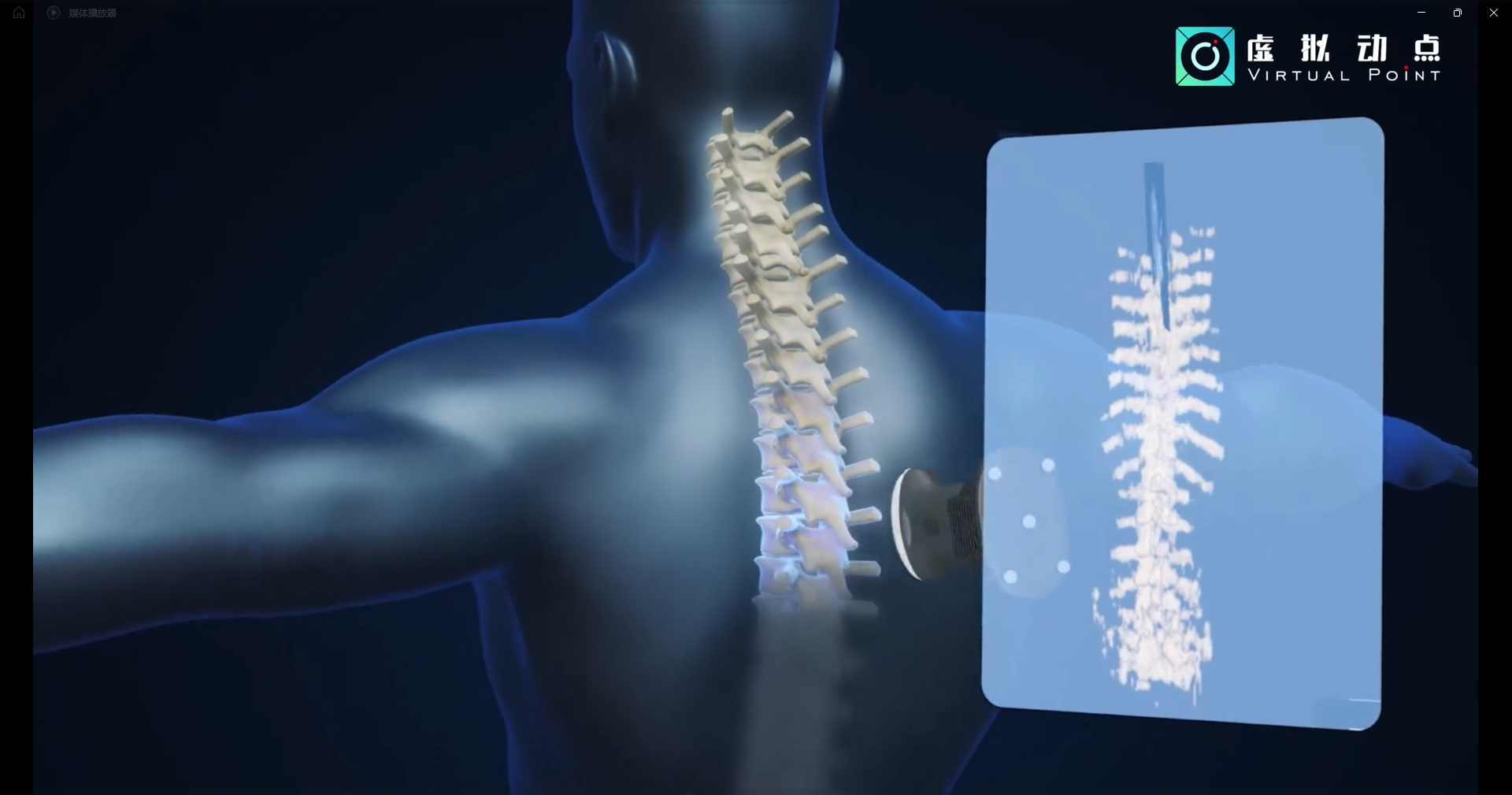壹定发·虚拟动点OptiTrack开创3D超声成像在脊柱诊断中的应用